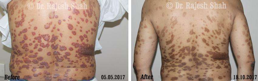 lifeforce homeopathy case-photos
